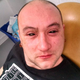 Illustration for article titled This Biohacker Used Eyedrops To Give Himself Temporary Night Vision